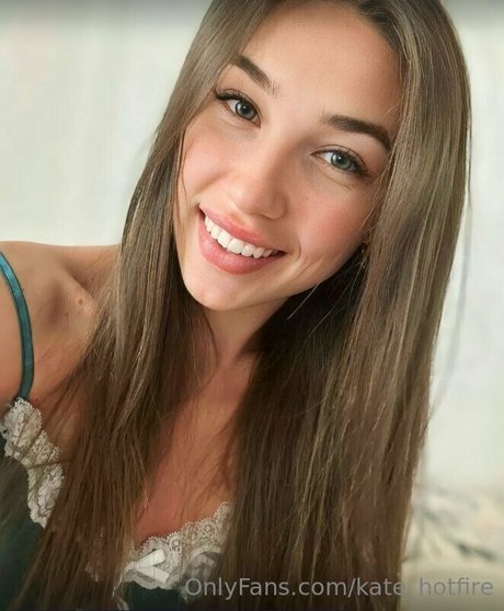 Kate_hotfire