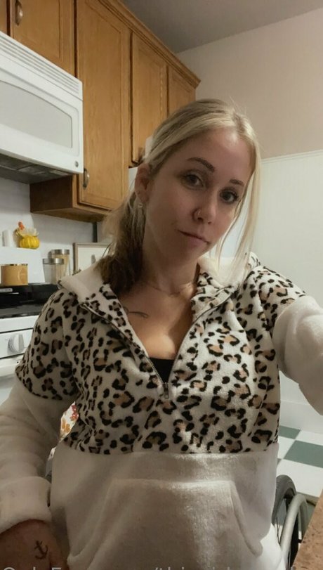 Thisgirlwheelsamputee